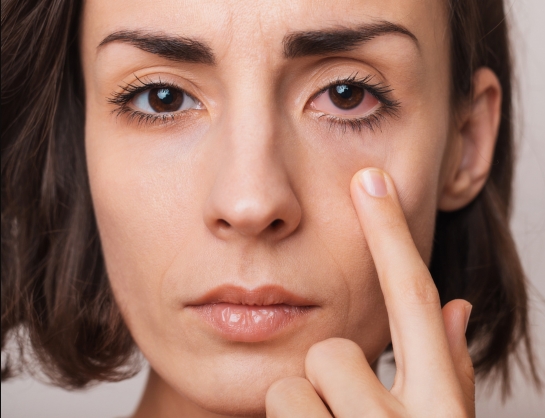 Monitor kar beállítás